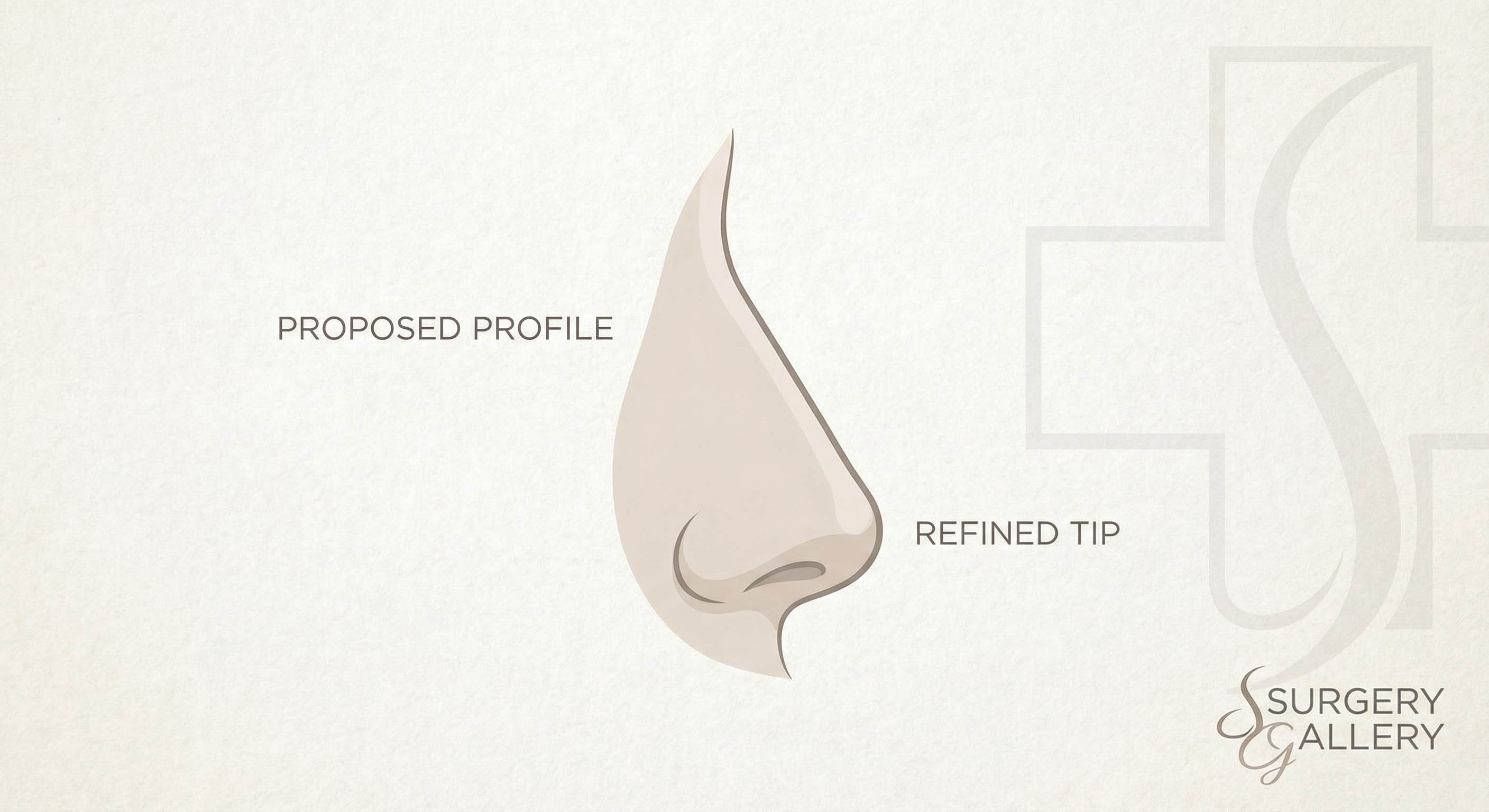 Barbie Tipi Rhinoplasty